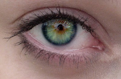heterochromia brown blue